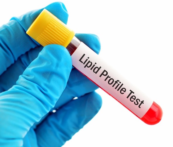 Lipid Profile - Fasted State